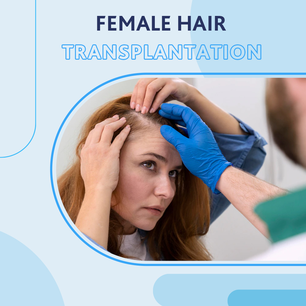 Female Hair Transplantation
