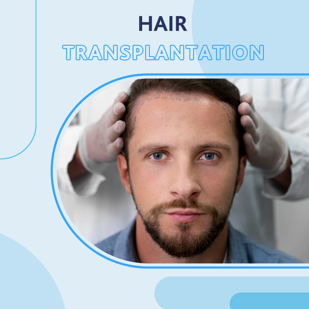 Burtom Hair Transplant Center ‣ Hair Transplant in Turkey